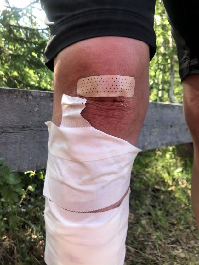 Svullet knä efter smällen!